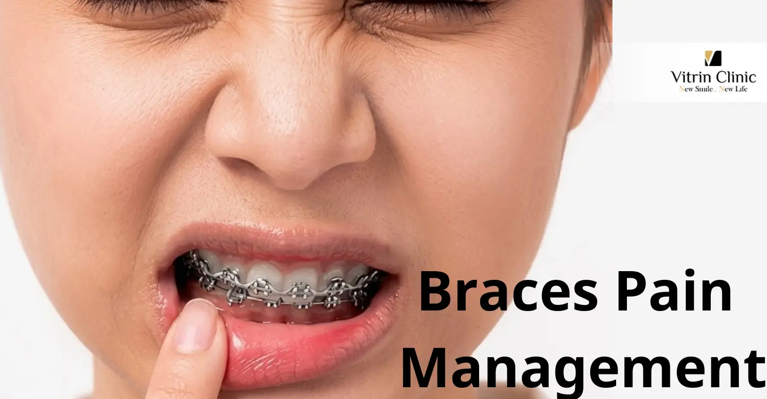 Schmerzmanagement bei Zahnspangen: Wie man Beschwerden während der kieferorthopädischen Behandlung lindert